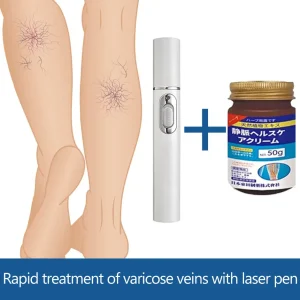 Varicose Veins Laser Pen